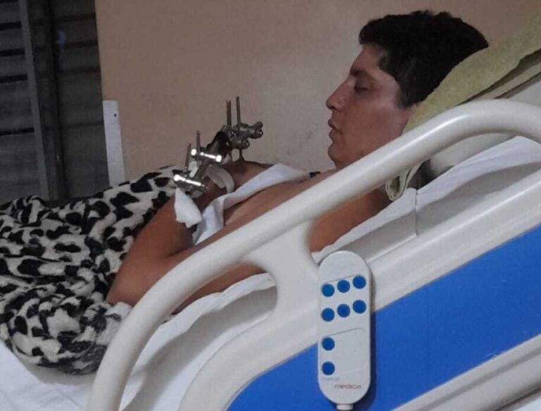 Grave denuncia: operario acusa abandono tras caer desde ocho metros en una obra de Dagna