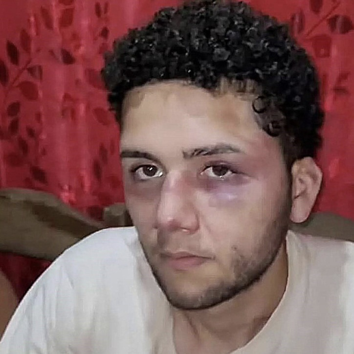 Sus empleadores no le querían pagar su sueldo y lo golpearon brutalmente